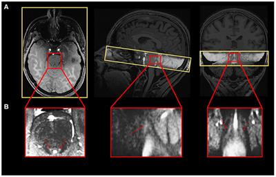 Structural and functional characterization of the locus coeruleus in young and late middle-aged individuals